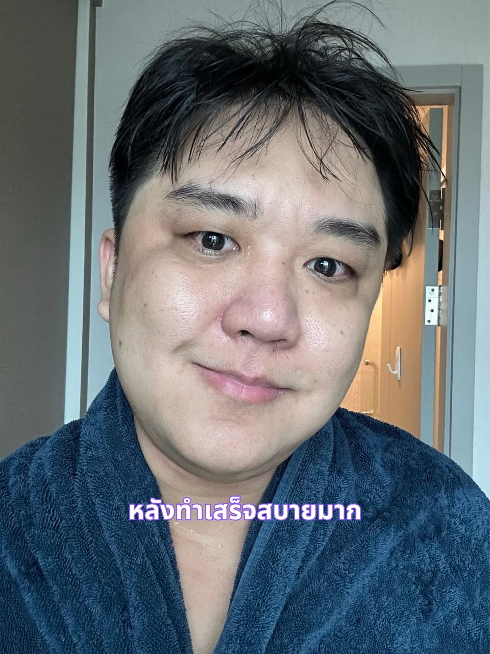 เลเซอร์ขน 3 พลังงาน Apex Profound Beauty รูปที่ 4